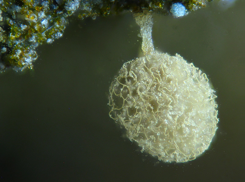 Arcyria (pomiformis ?)